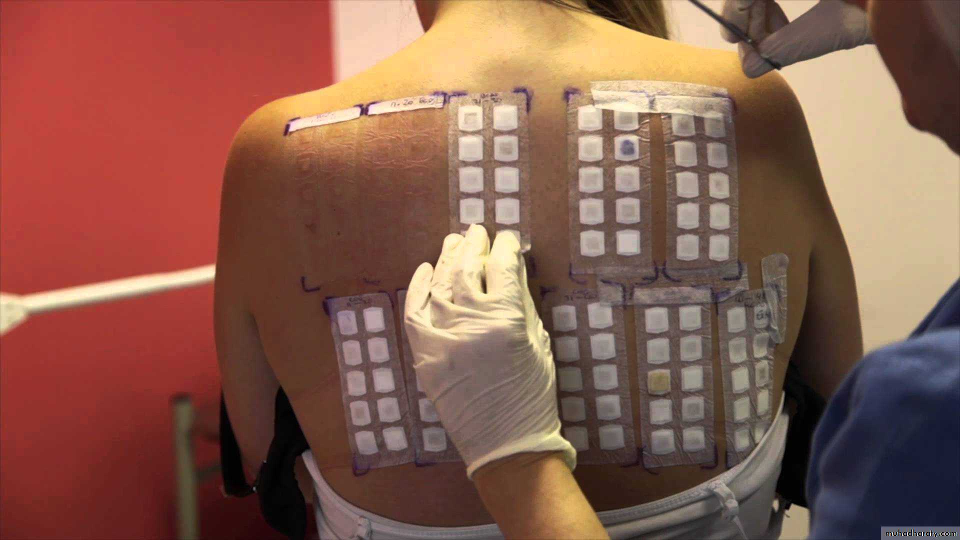 Testări alergologice gratuite la Spitalul Universitar