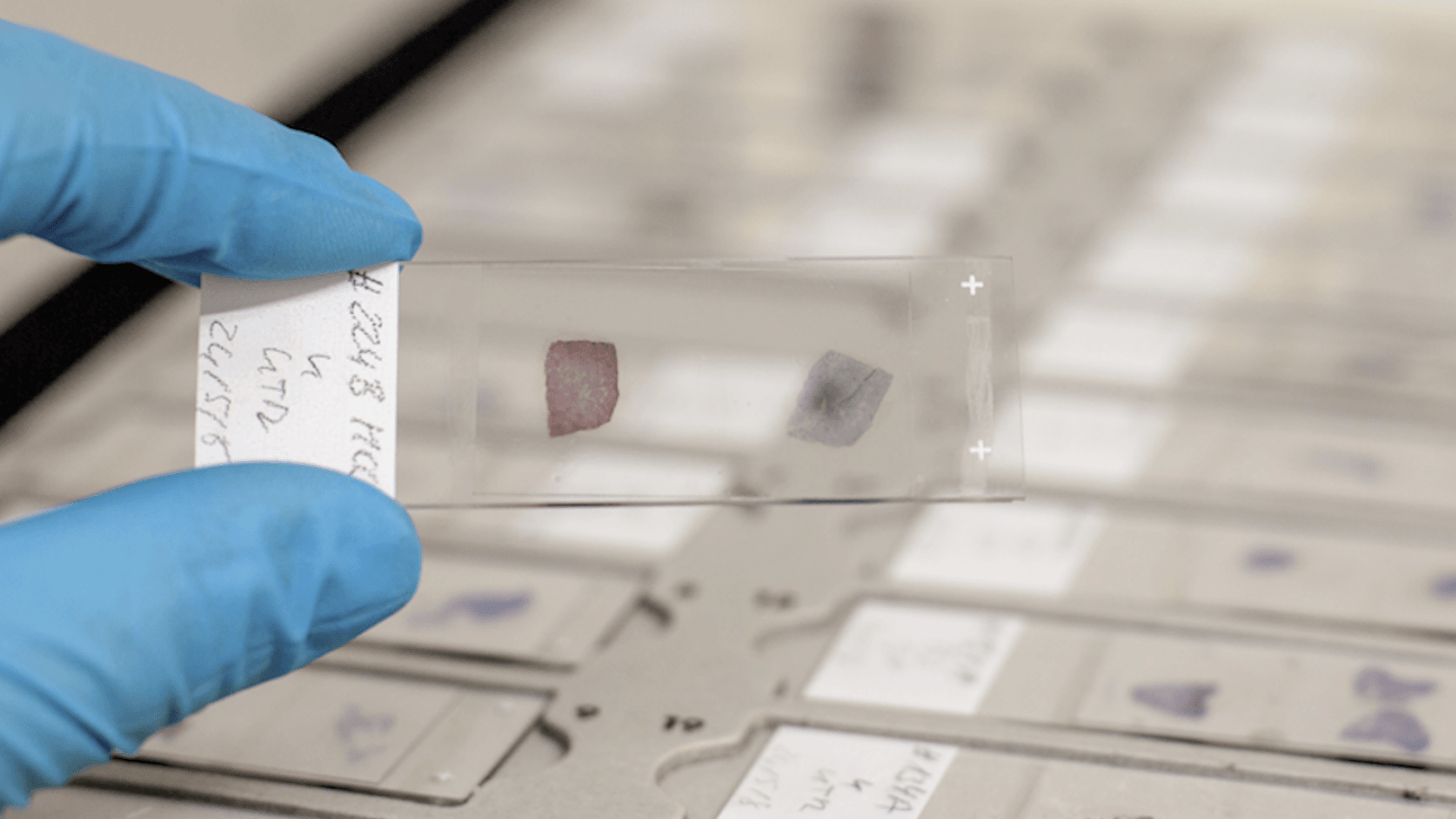 Diagnosticul, cea mai mare problemă a pacienților