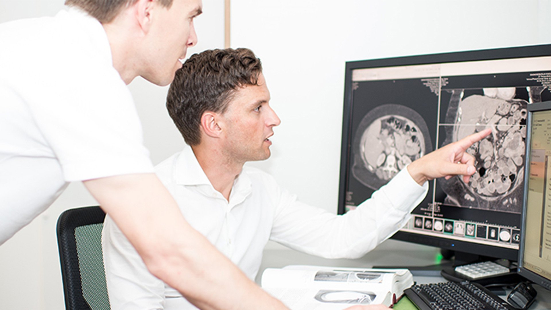 Cafeaua scade riscul de a face cancer la ficat